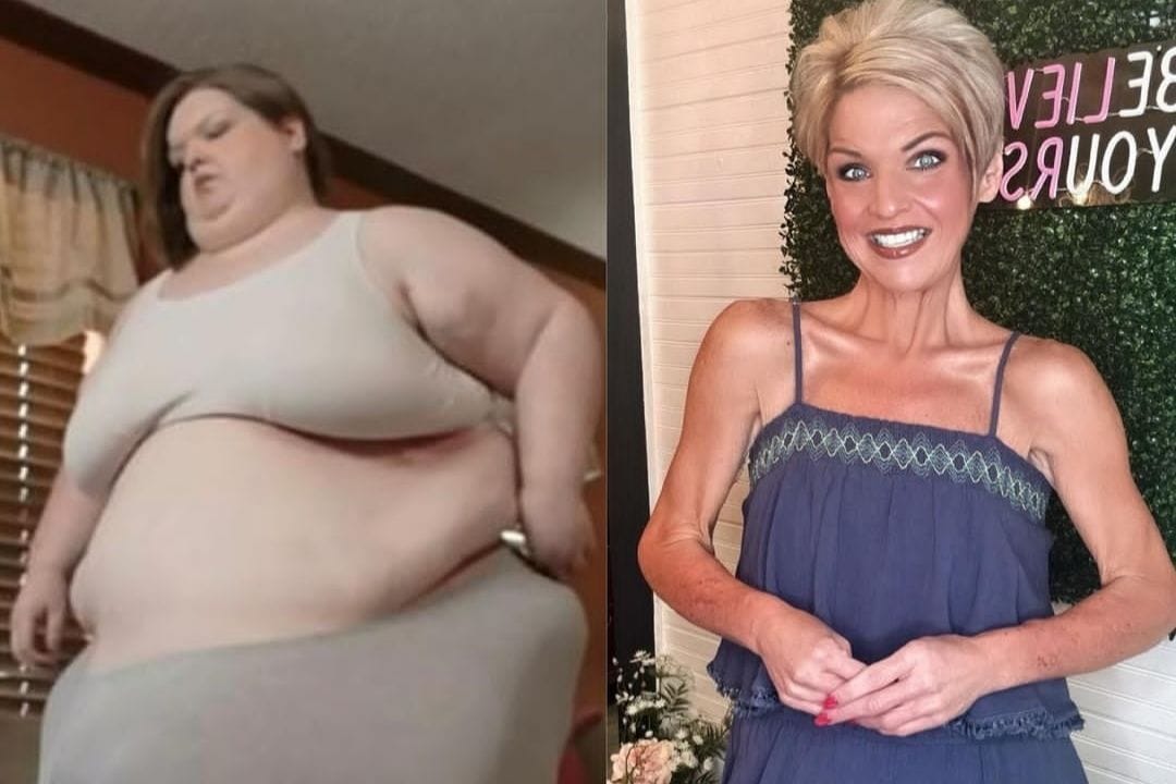 Amanda Johnson wog vor ihrer Gewichtsabnahme knapp 324 Kilo. Heute hält sie ihr Gewicht von rund 50 Kilo. Amanda Johnson wog vor ihrer Gewichtsabnahme knapp 324 Kilo. Heute hält sie ihr Gewicht von rund 50 Kilo.