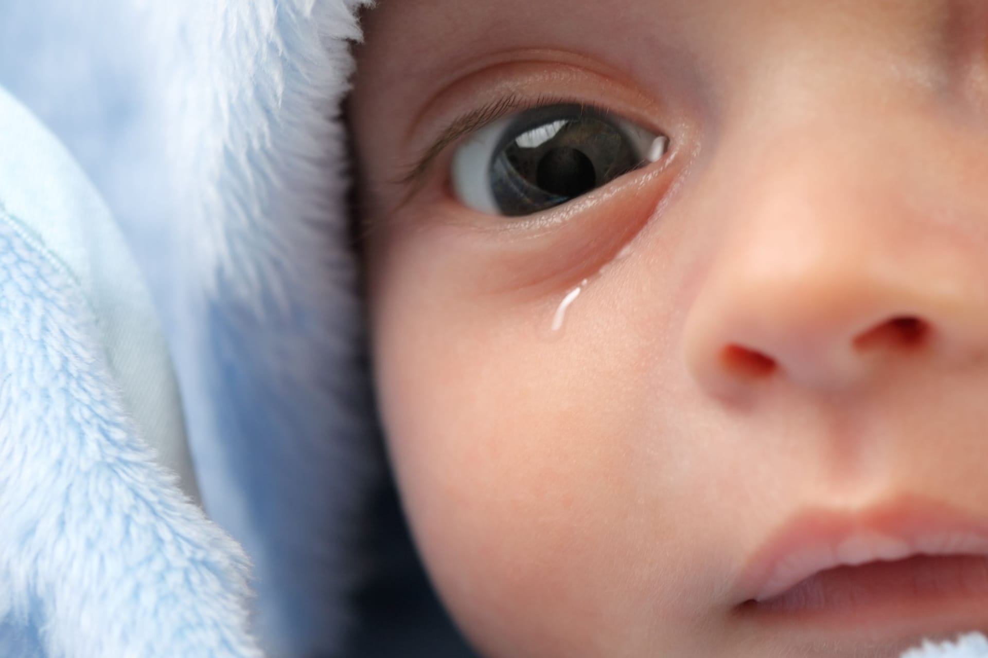 Baby mit tränendem Auge: Tränen die Augen beim Baby oder Kleinkind ständig, ist womöglich eine angeborene Tränenwegsstenose die Ursache. Baby mit tränendem Auge: Tränen die Augen beim Baby oder Kleinkind ständig, ist womöglich eine angeborene Tränenwegsstenose die Ursache.