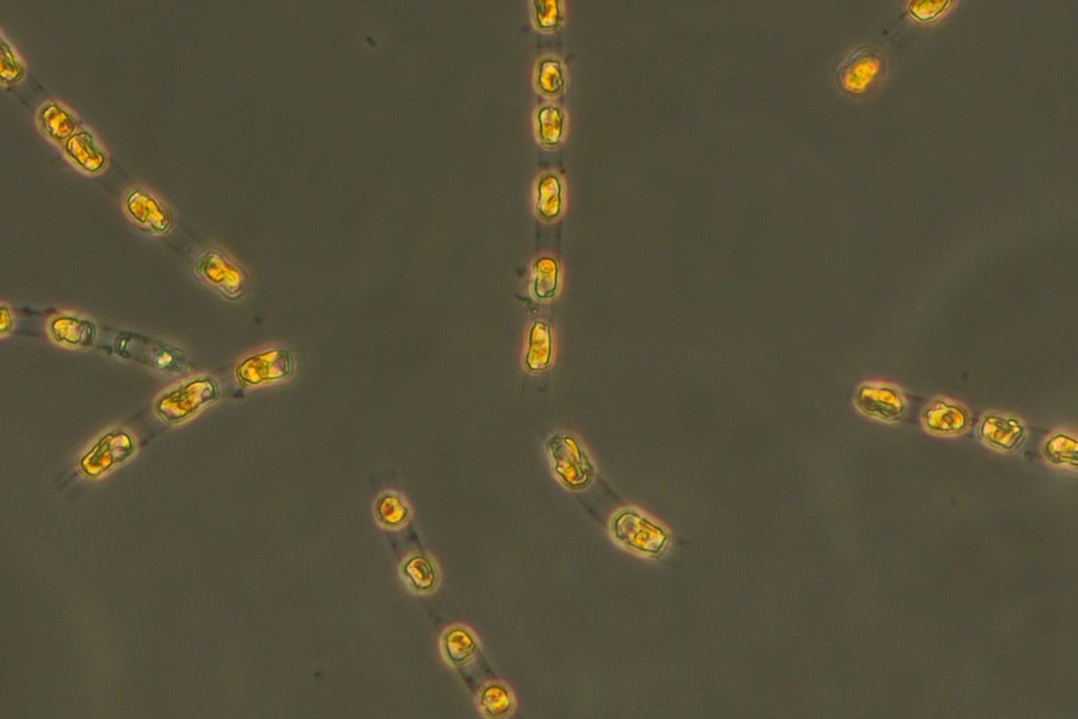 Robust: Diese Kieselalgen wurden nach 7.000 Jahren wiederbelebt. Robust: Diese Kieselalgen wurden nach 7.000 Jahren wiederbelebt.